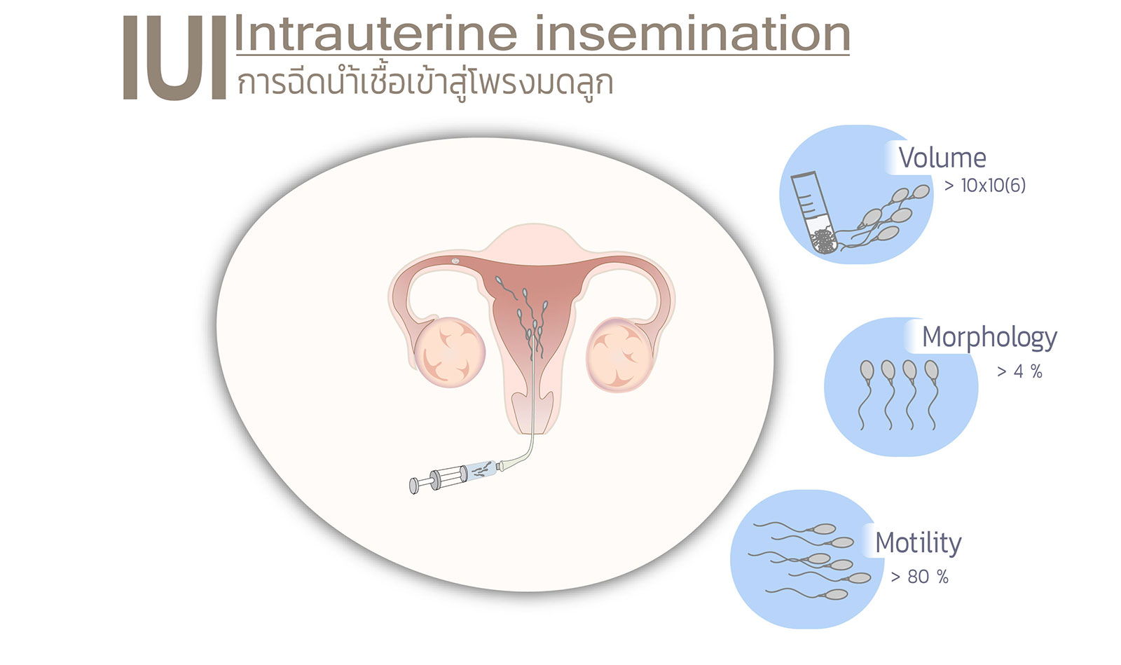 414_iui_illustration.jpg