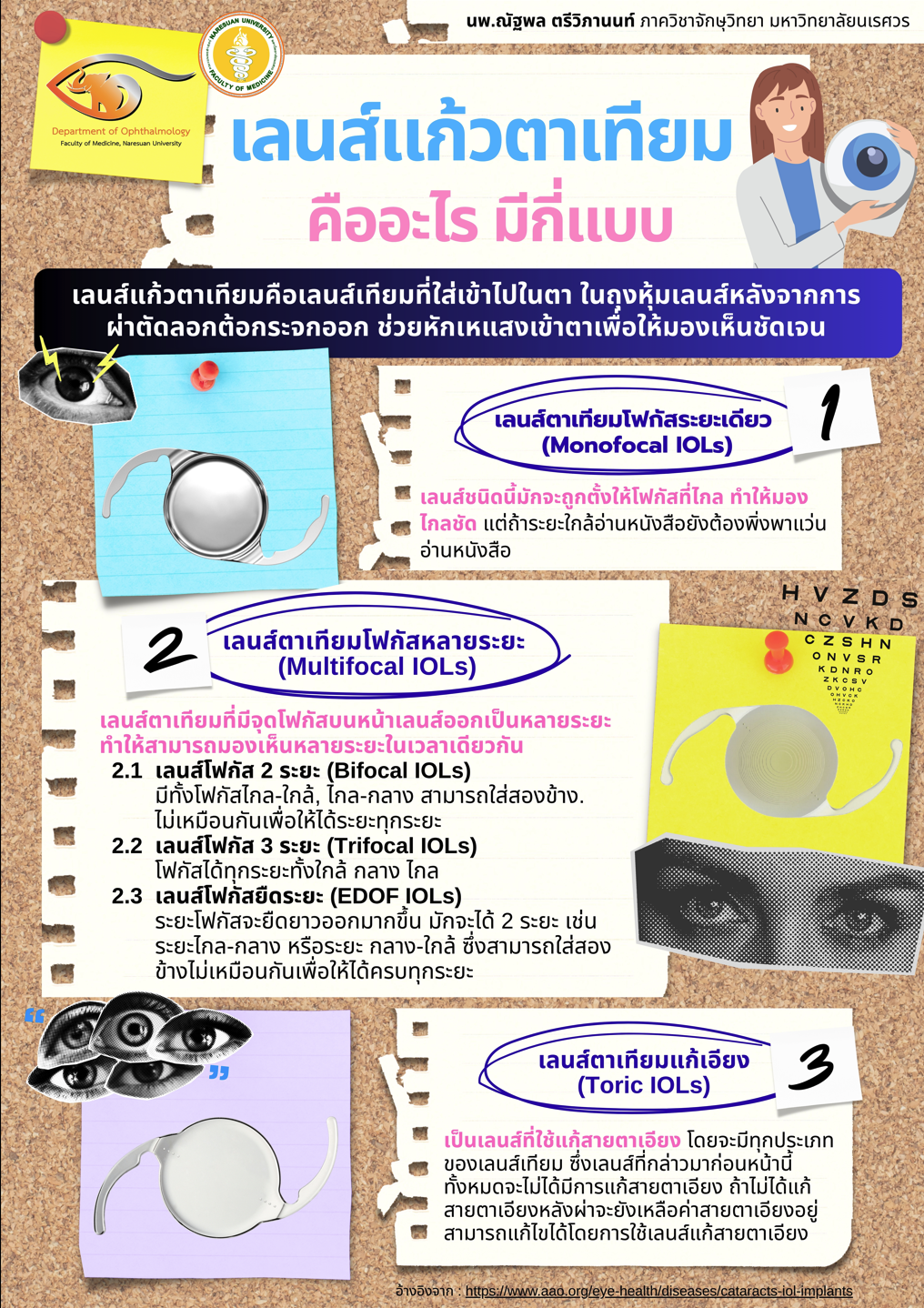 เลนส์แก้วตาเทียม คืออะไร มีกี่แบบ