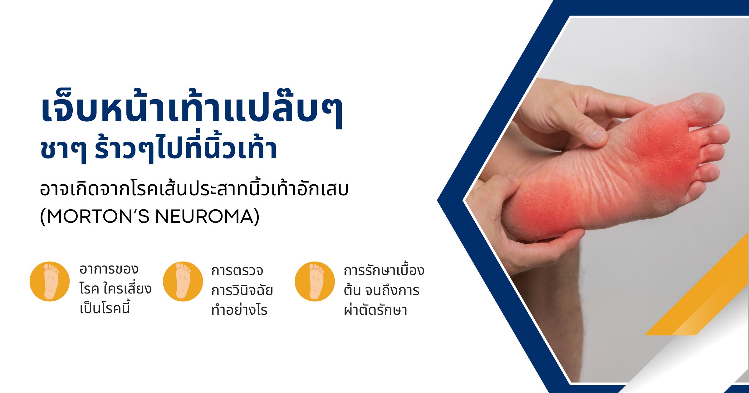 โรคประสาทนิ้วอักเสบ