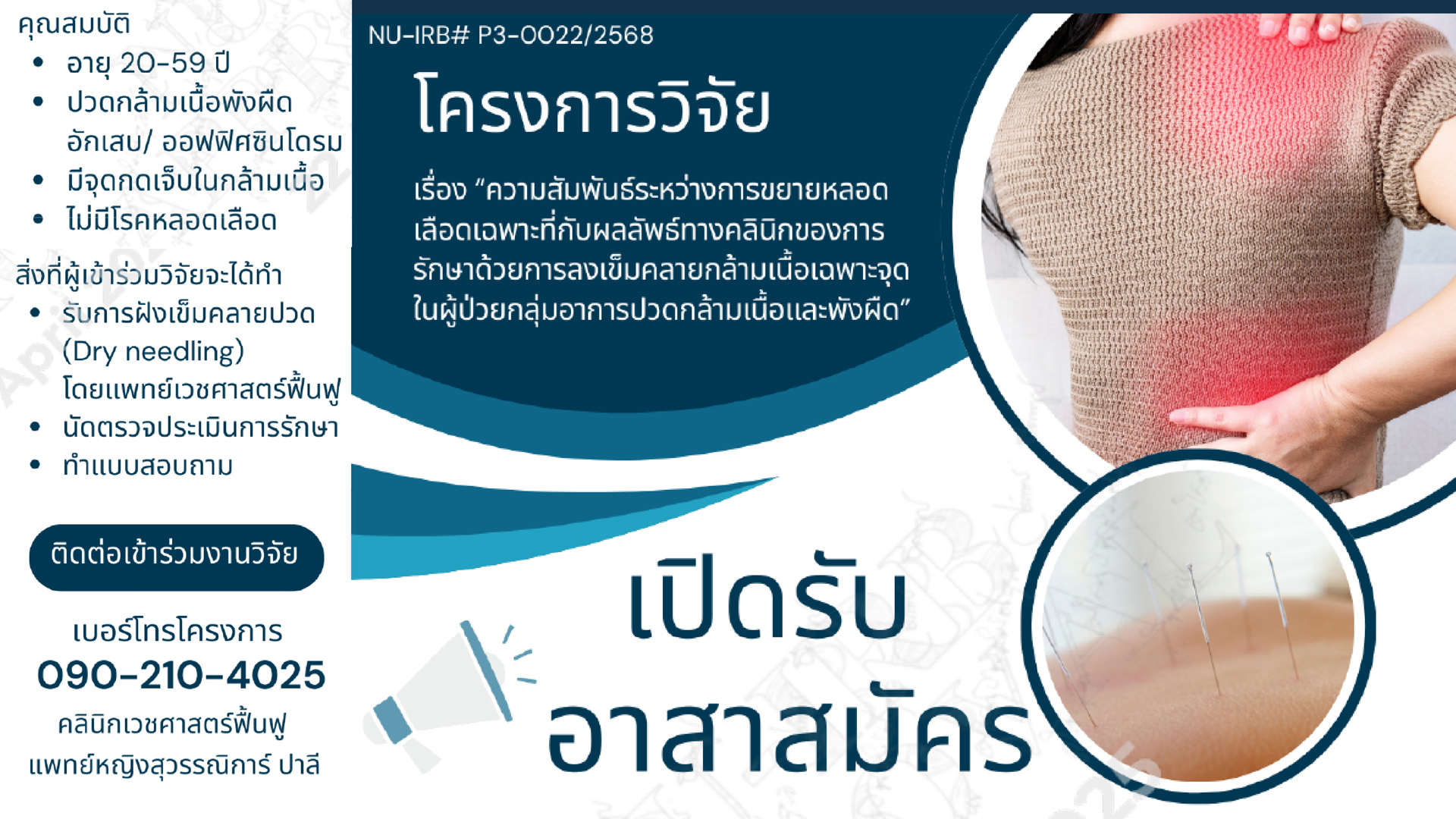 โครงการวิจัยเปิดรับอาสาสมัคร
